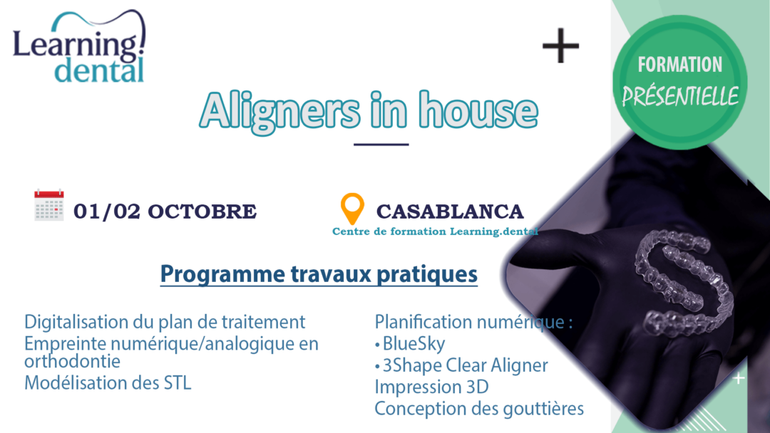 Aligners In-House
