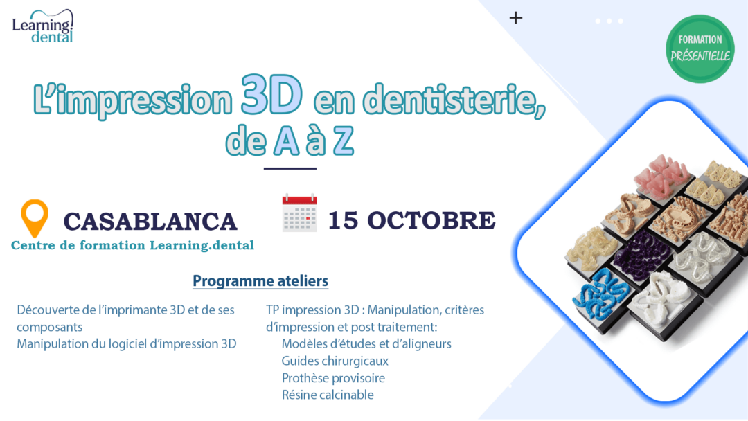L’impression 3D en dentisterie, de A à Z