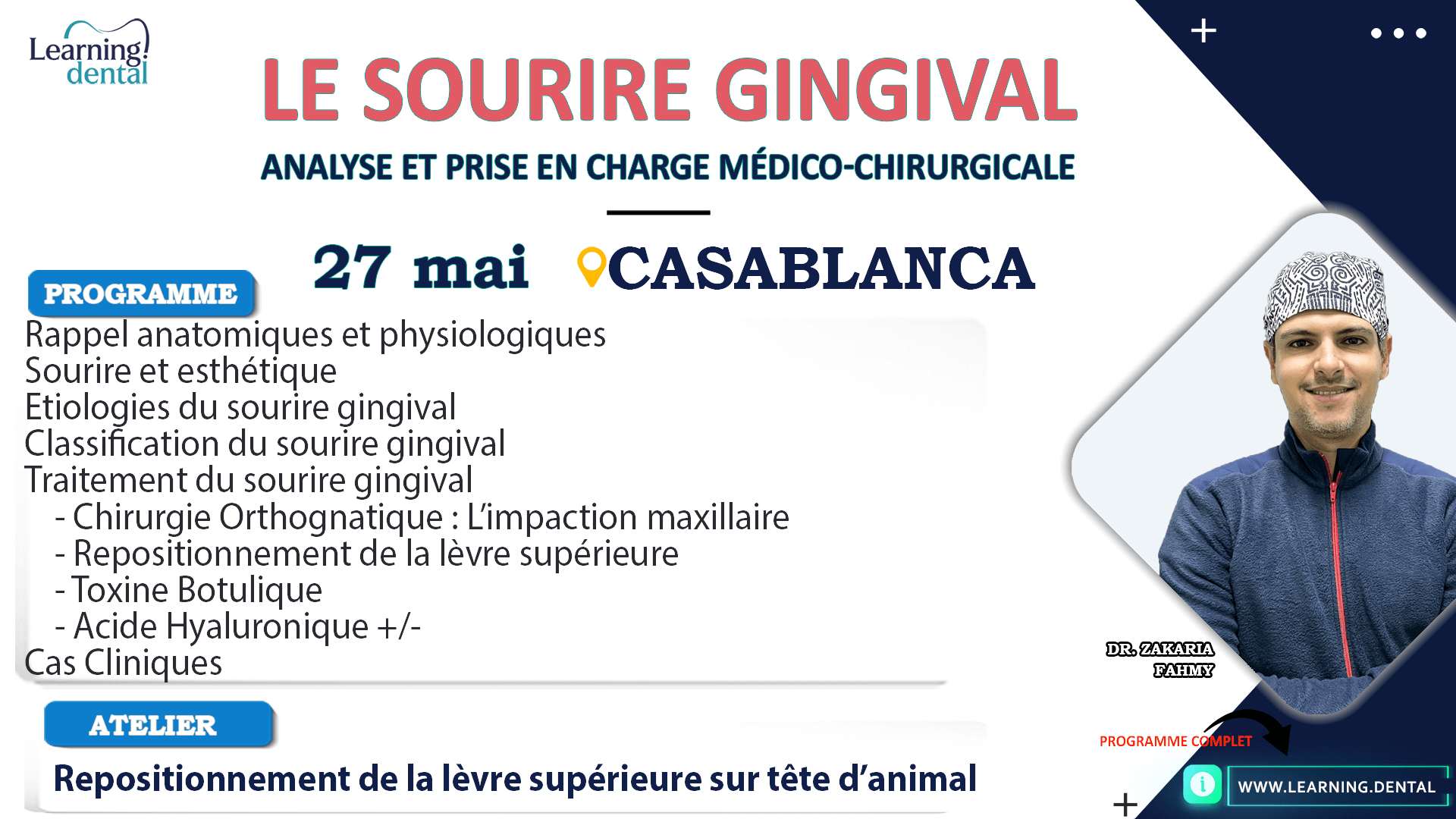 Le sourire gingival : Analyse et prise en charge médico-chirurgicale