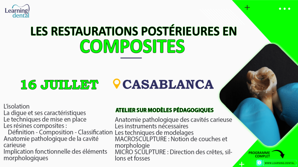 Les restaurations postérieures en composites