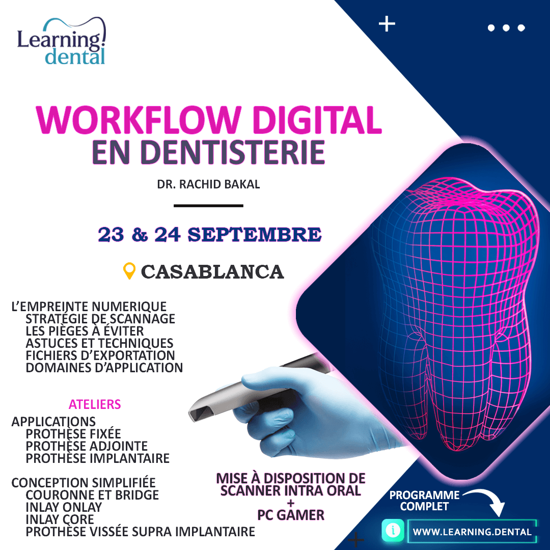 Workflow digital en dentisterie