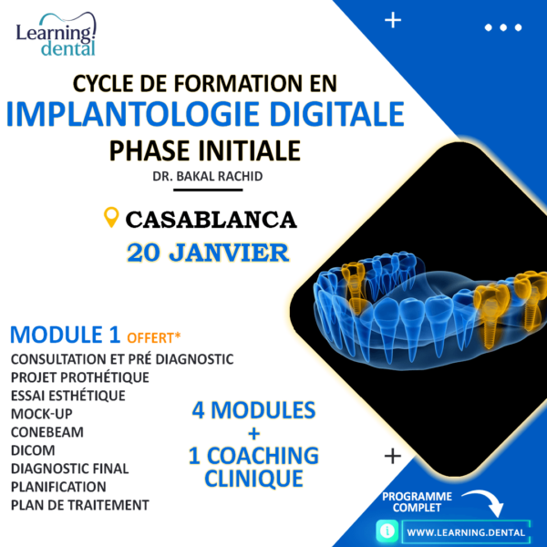 Formation en implantologie digitale Phase initiale Casablanca Maroc