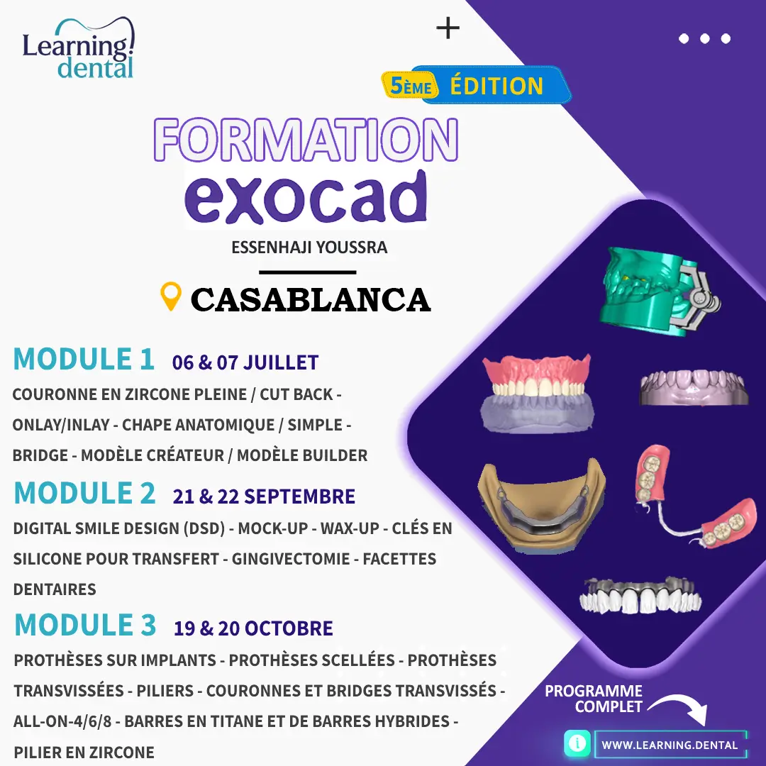Formation exocad