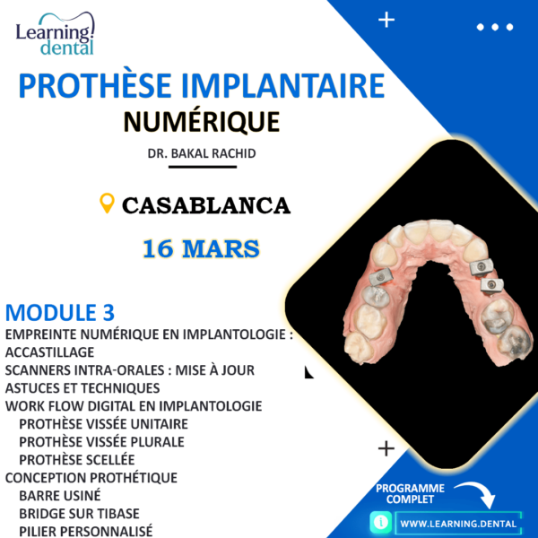 Formation prothèse implantaire numérique Casablanca Maroc