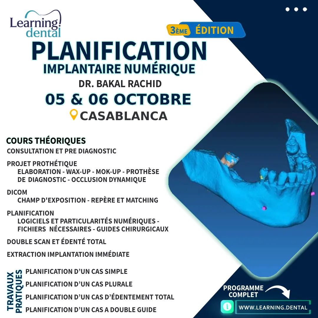 Planification implantaire numérique