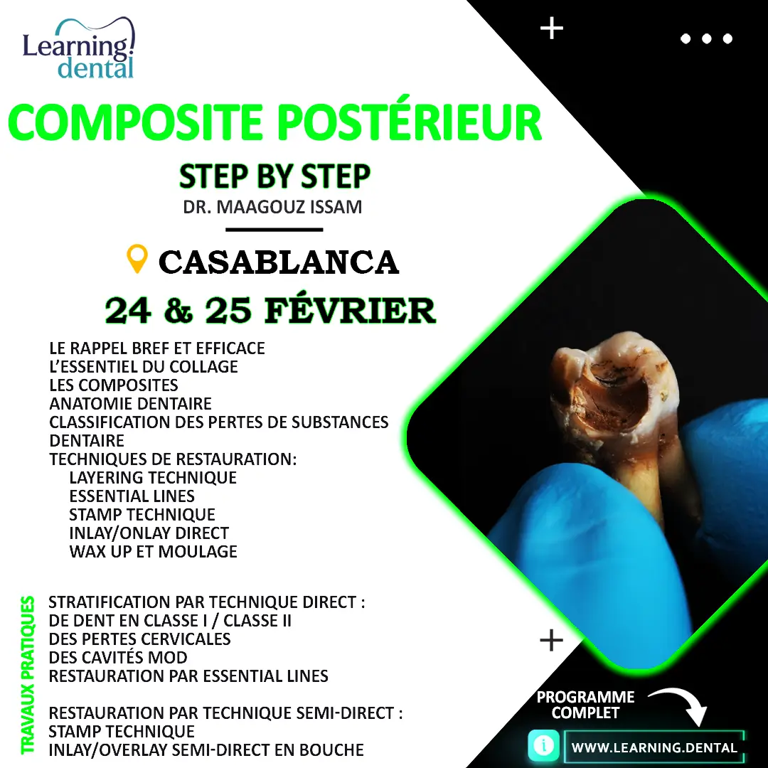 Composite Postérieur Step by Step