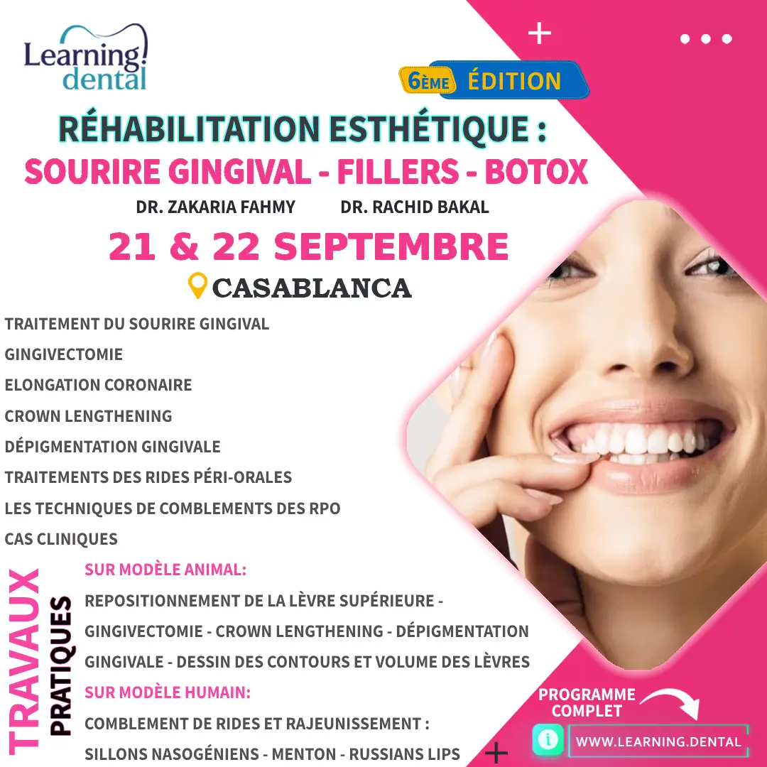 Réhabilitation esthétique: Sourire Gingival, Fillers et Botox