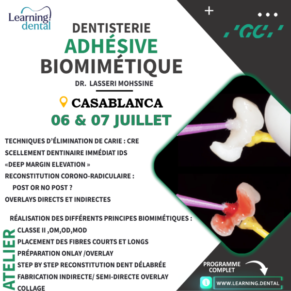 Dentisterie adhésive biomimétique