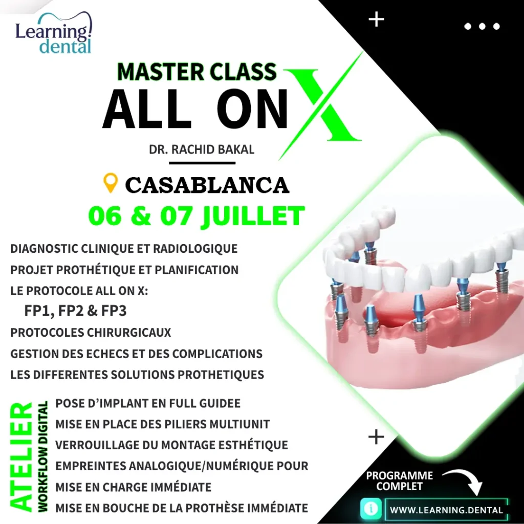 Master Class All on X