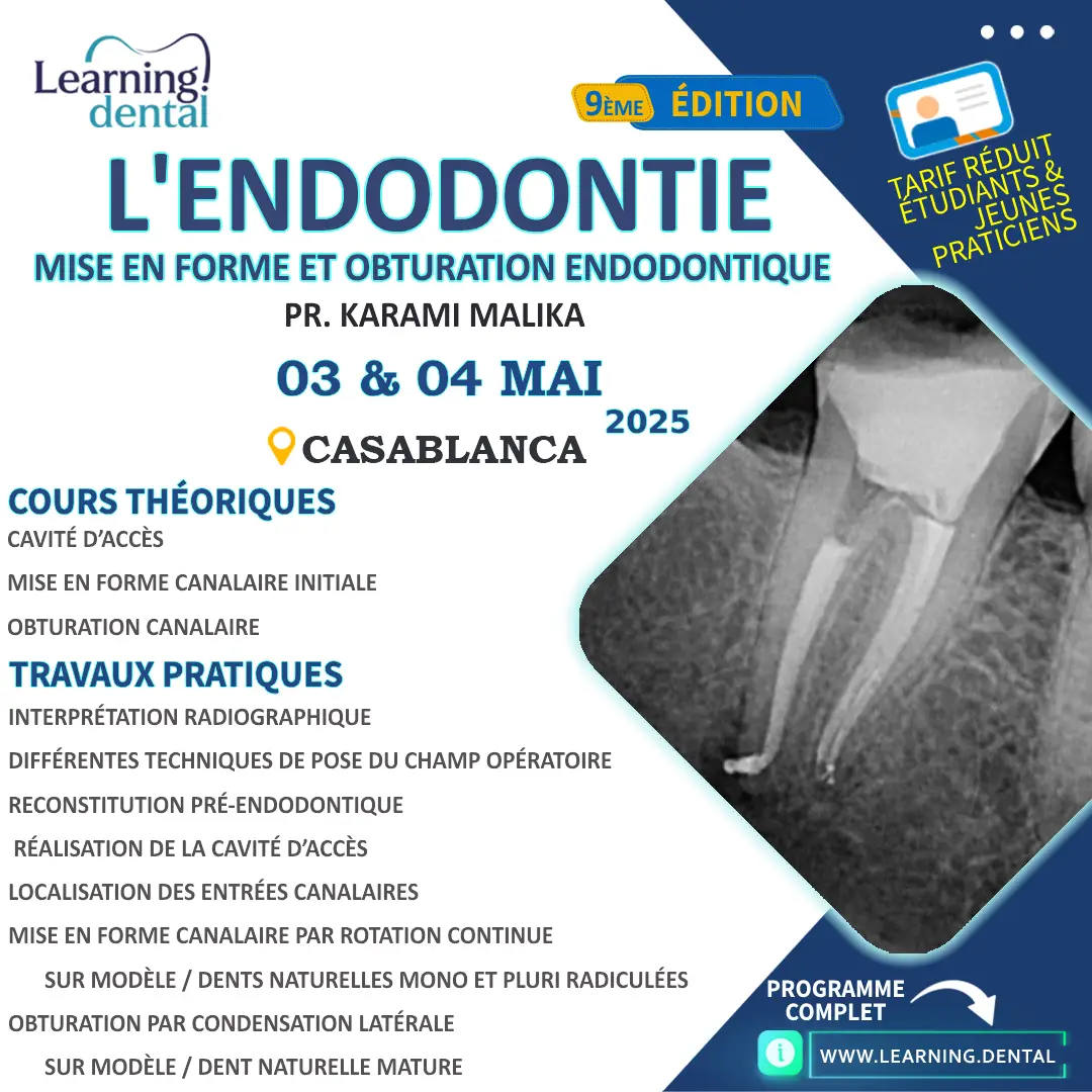 Endodontie Mise en forme et obturation