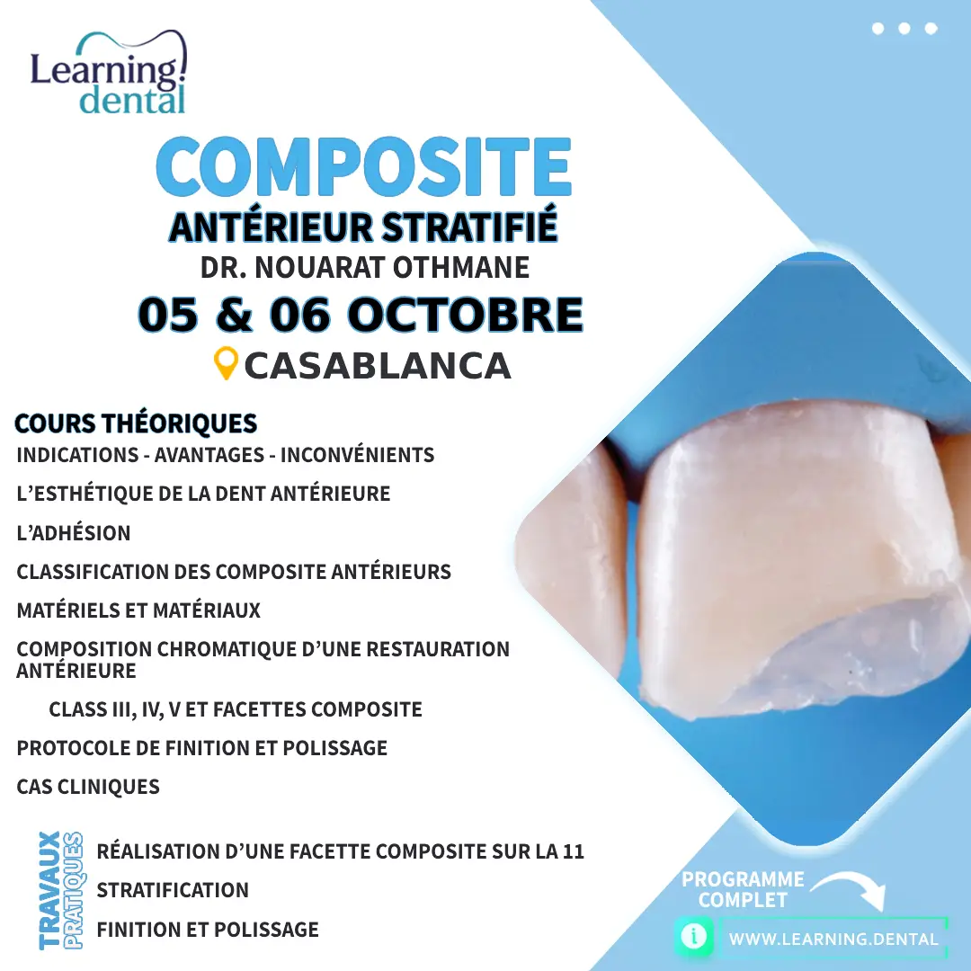 Formation en Composite antérieur stratifié