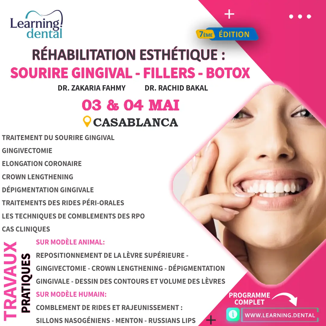 Réhabilitation esthétique Sourire Gingival, Fillers et Botox