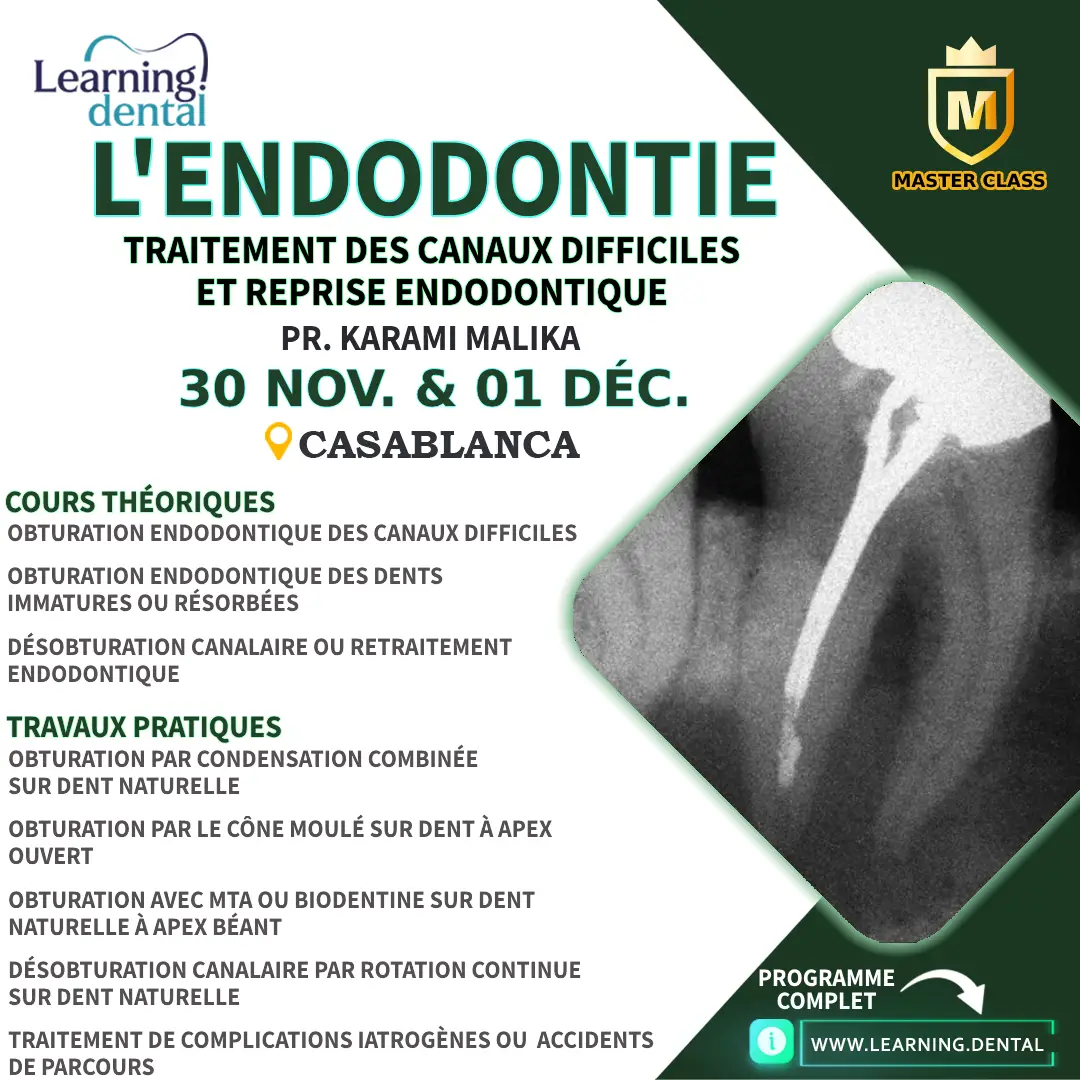 Traitement des canaux difficiles et reprise endodontique