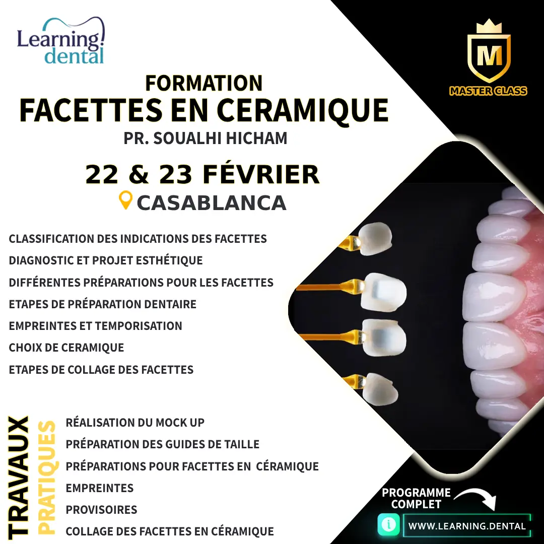 Formation en facettes en céramique