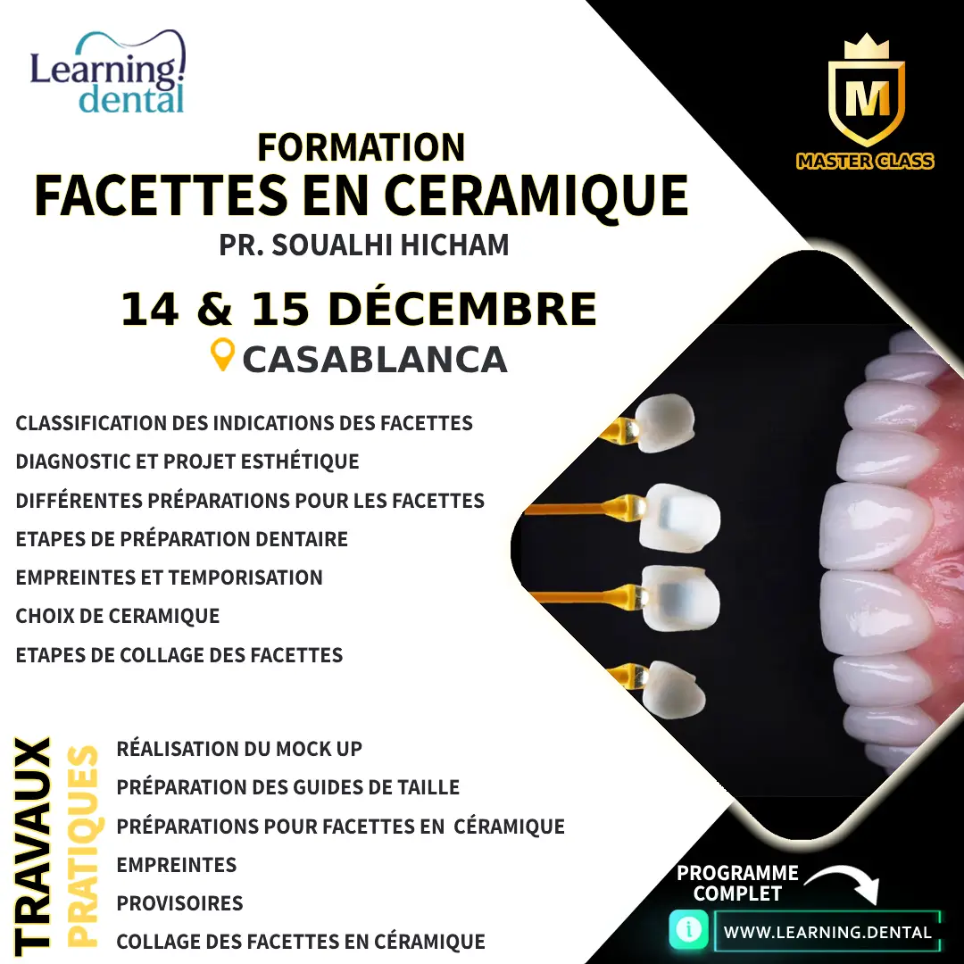 Formation en facettes en céramique