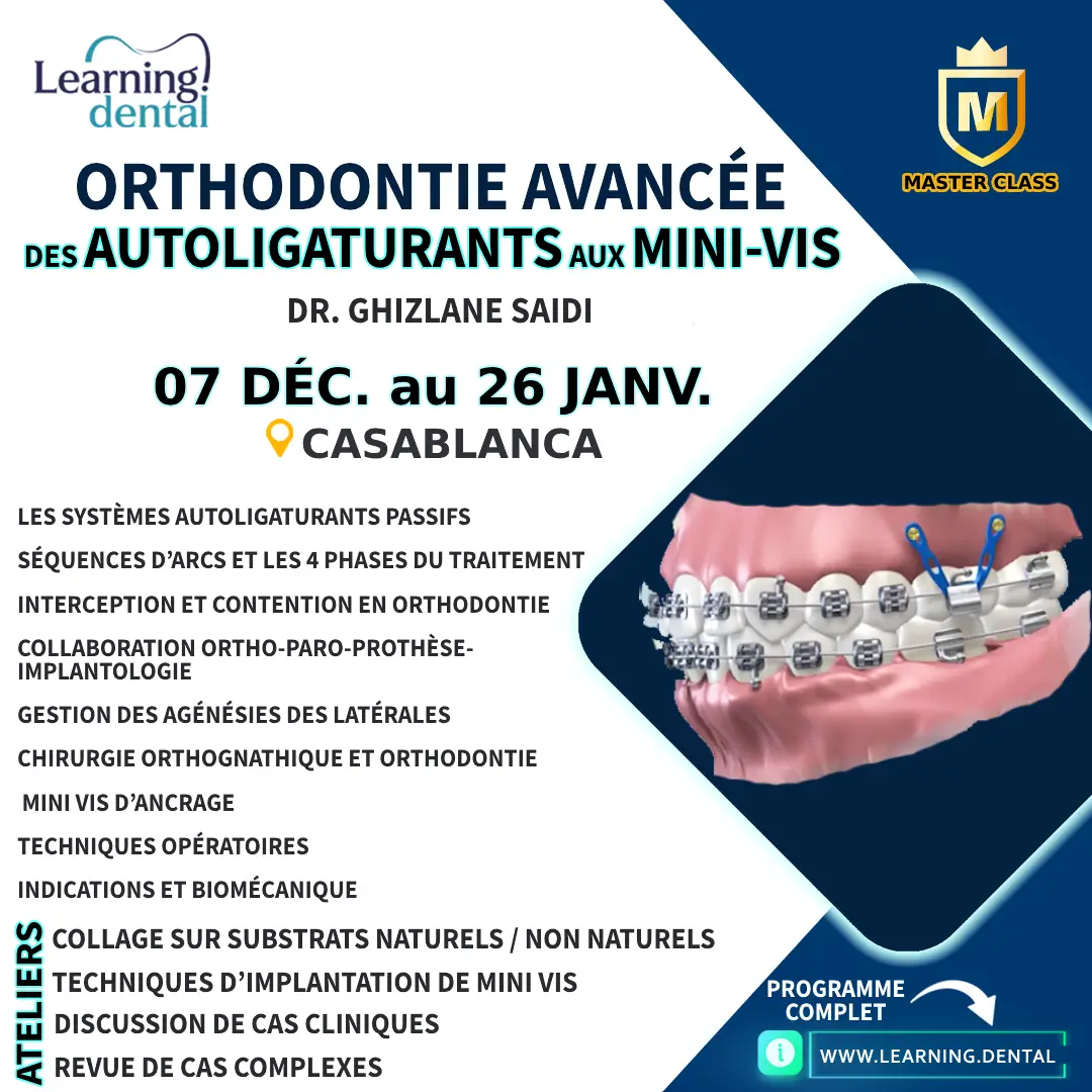 Orthodontie avancée: des autoligaturants aux mini-vis