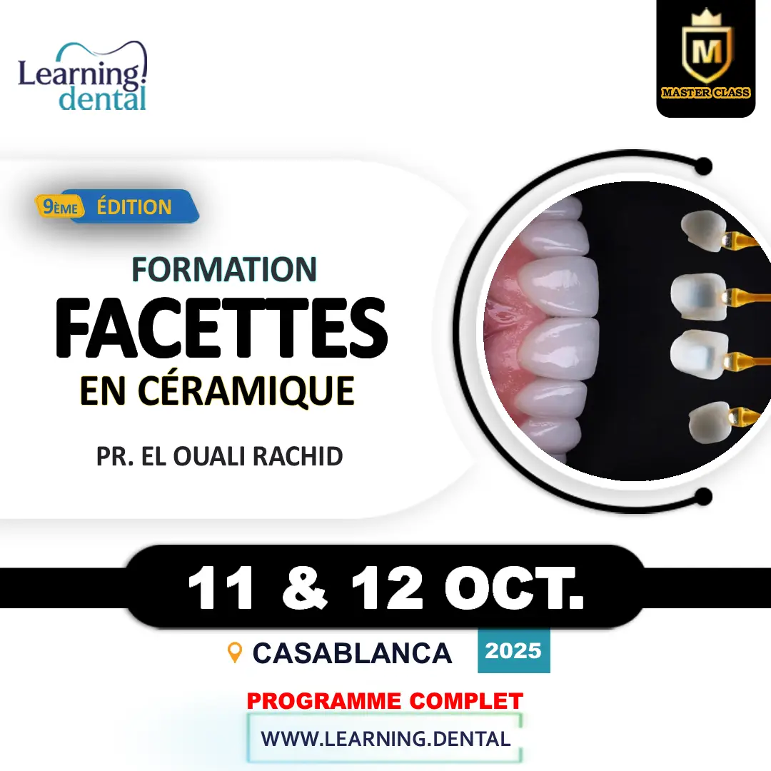 Formation en facettes en céramique
