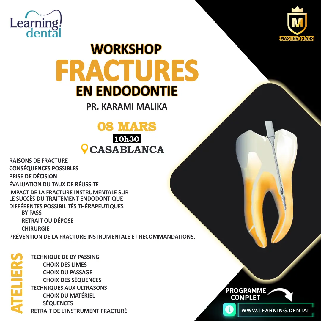 Fractures en endodontie