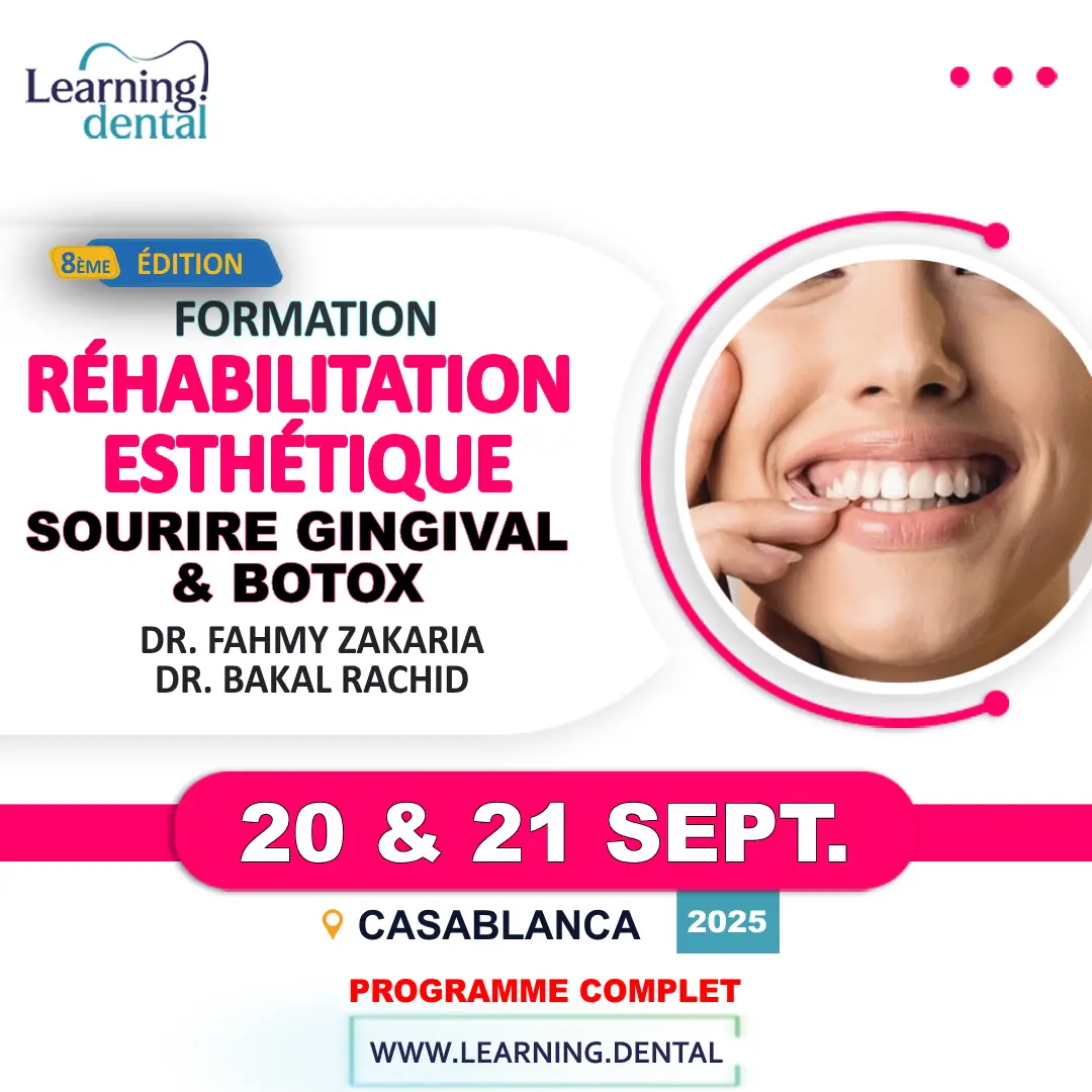 Réhabilitation esthétique: Sourire Gingival et Botox 13 Réhabilitation esthétique Sourire Gingival et Botox