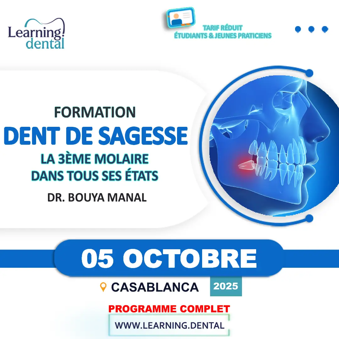 Formation Dent de sagesse