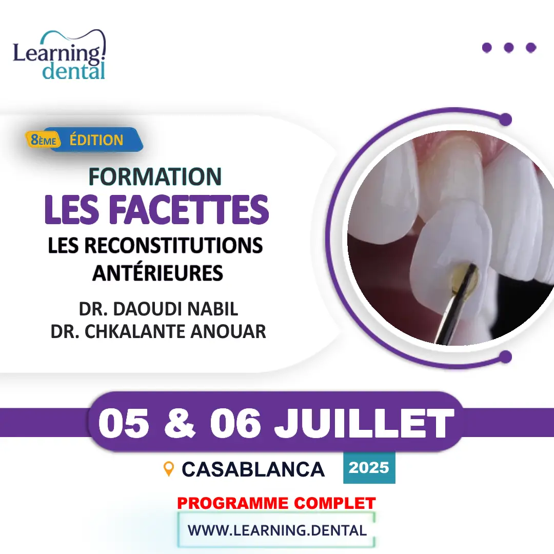 Facettes Les Reconstitutions Antérieures