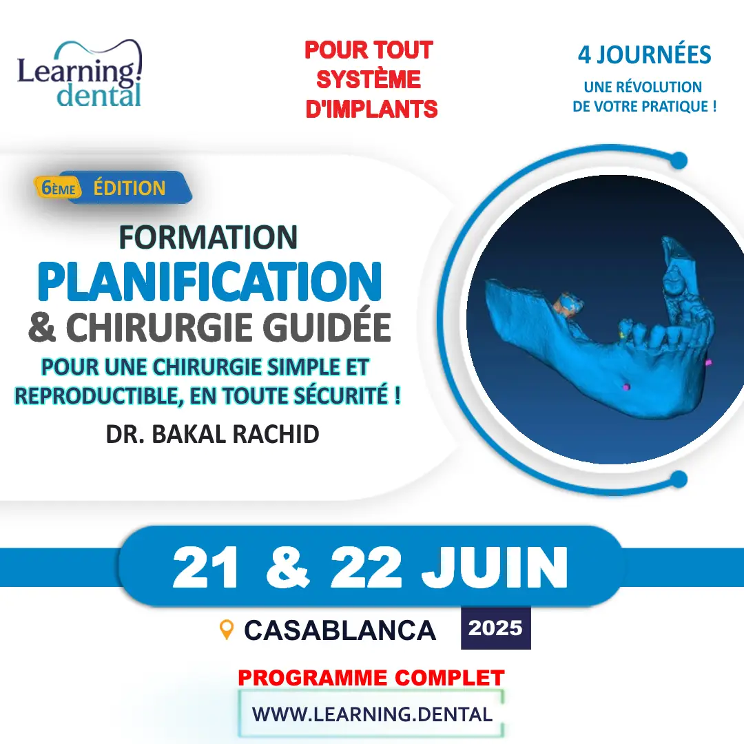 Planification implantaire