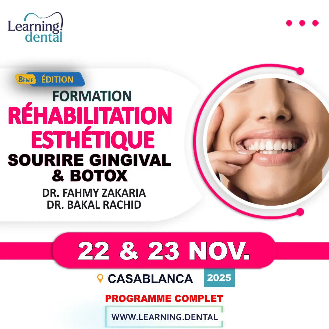 Réhabilitation esthétique Sourire Gingival et Botox