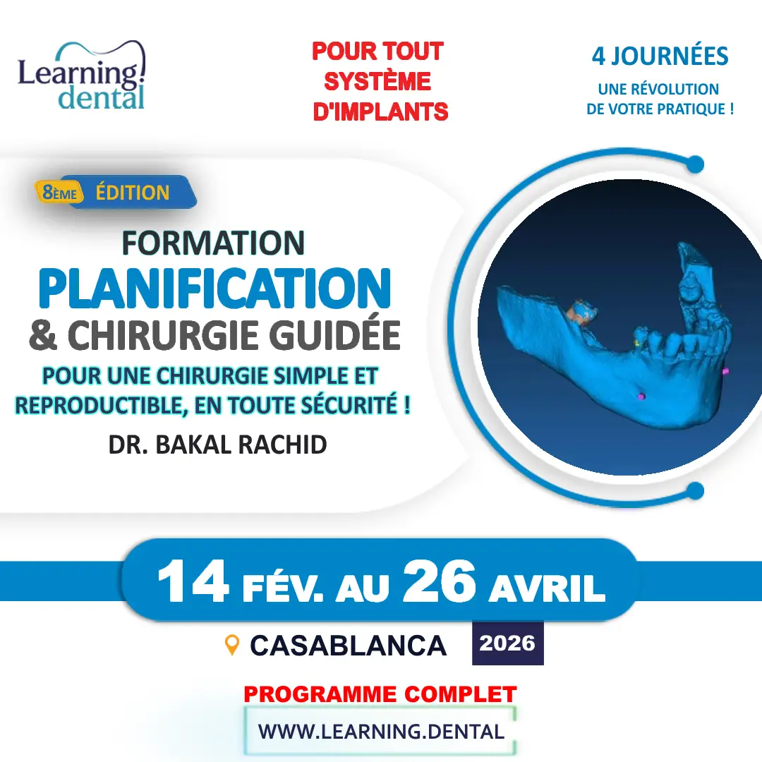 Planification implantaire numérique et chirurgie guidée 2 Planification implantaire numérique et chirurgie guidée