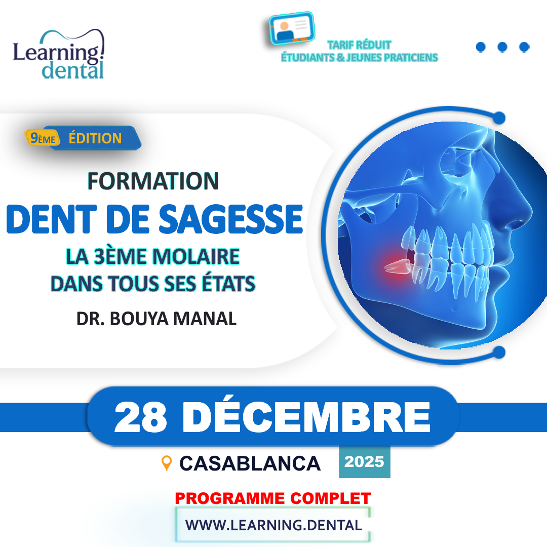 Formation Dent de sagesse