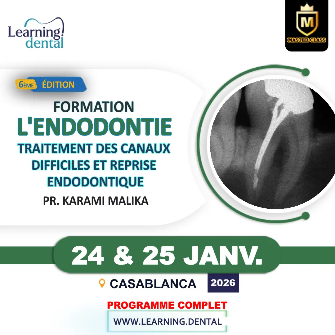 Traitement des canaux difficiles et reprise endodontique 20 Endodontie Reprise endodontique