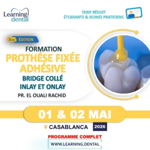 Formation Prothèse fixée adhésive Bridge collé Inlay et Onlay