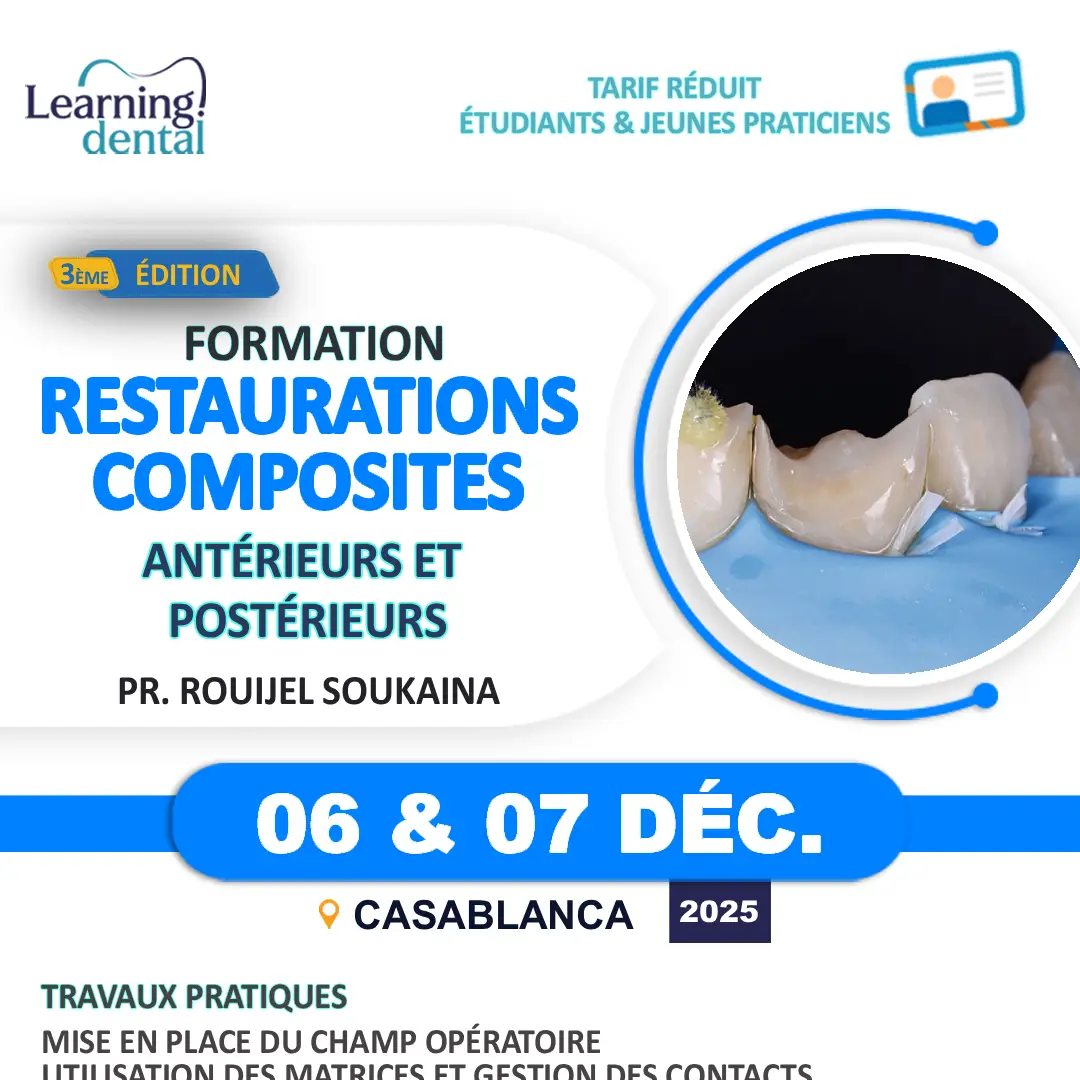 Restaurations directes aux composites antérieurs et postérieurs