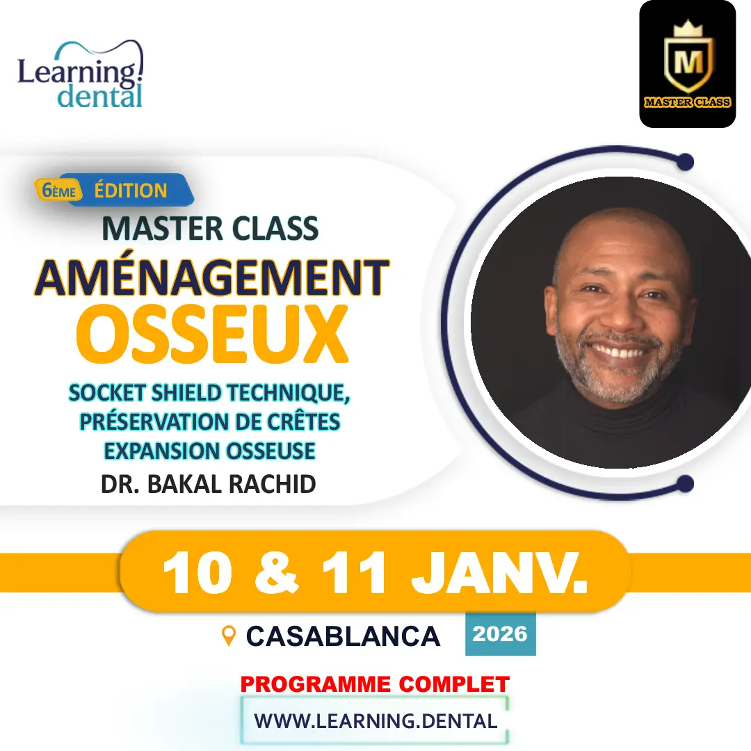 aménagement osseux en implantologie