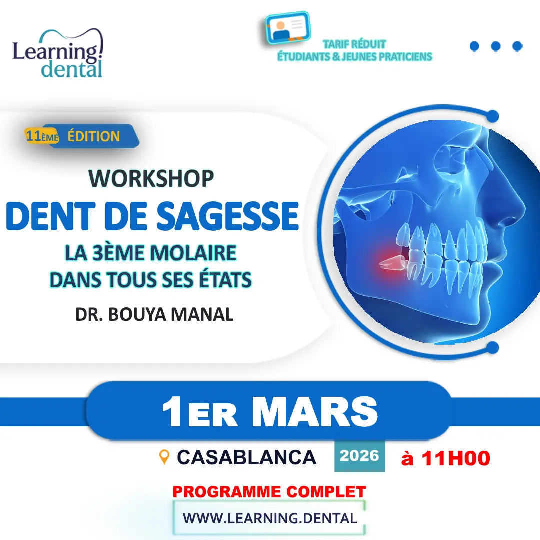 Formation Dent de sagesse