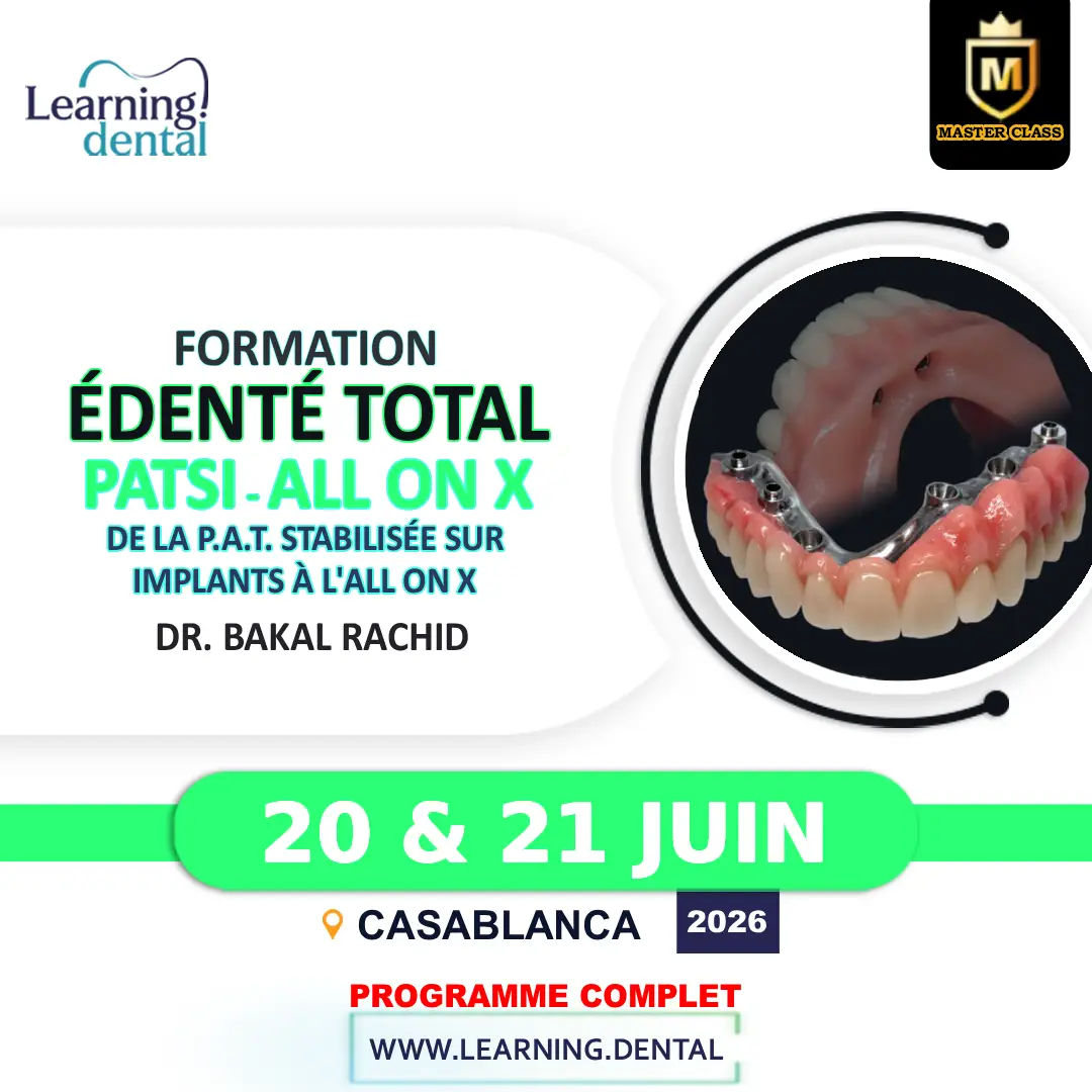 Formation édenté total: De la PATSI à l’ALL ON X 28 Formation édenté total De la PATSI à l’ALL ON X