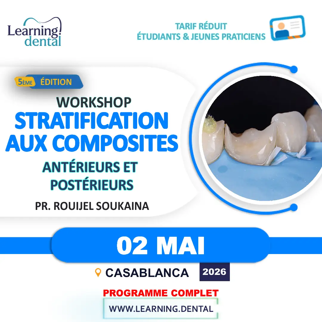Workshop stratification aux composites 26 Workshop stratification aux composites