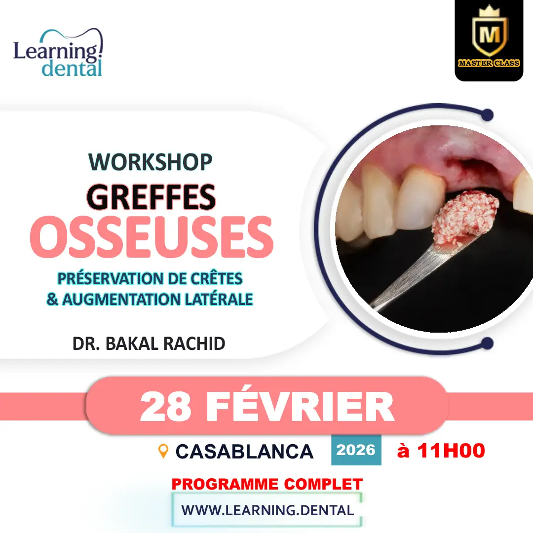 Workshop greffes osseuses