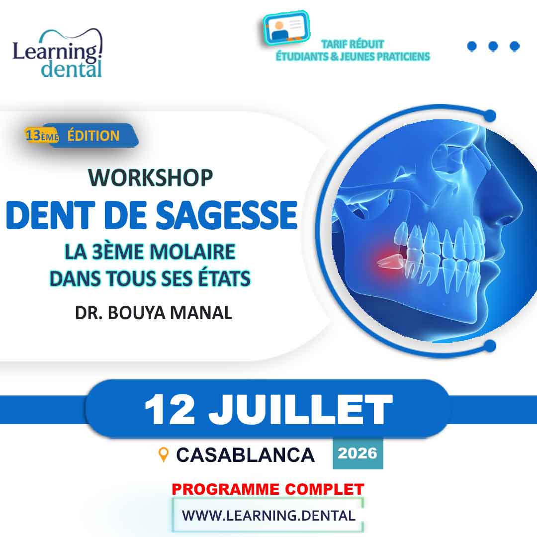 Formation dent de sagesse, la 3ème molaire 32 Formation Dent de sagesse