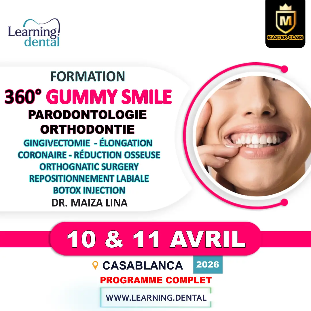 Formation 360° gummy smile