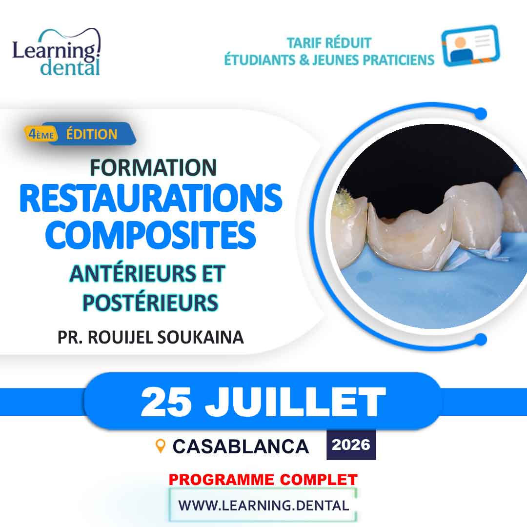 Workshop stratification aux composites 38 Workshop stratification aux composites