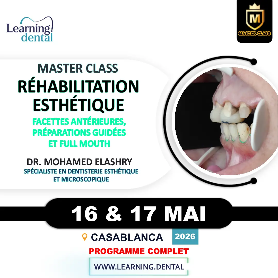 Master Class en réhabilitation esthétique dentaire 30 Master Class en réhabilitation esthétique dentaire