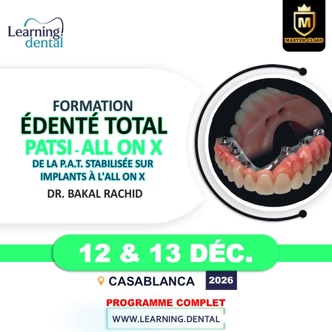 Formation édenté total: De la PATSI à l’ALL ON X 52 Formation édenté total De la PATSI à l’ALL ON X